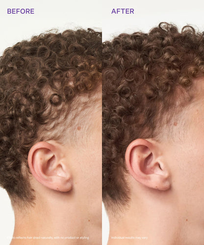 Scalp Revitalizing Solution Miracle in Shower Treatment — image 4