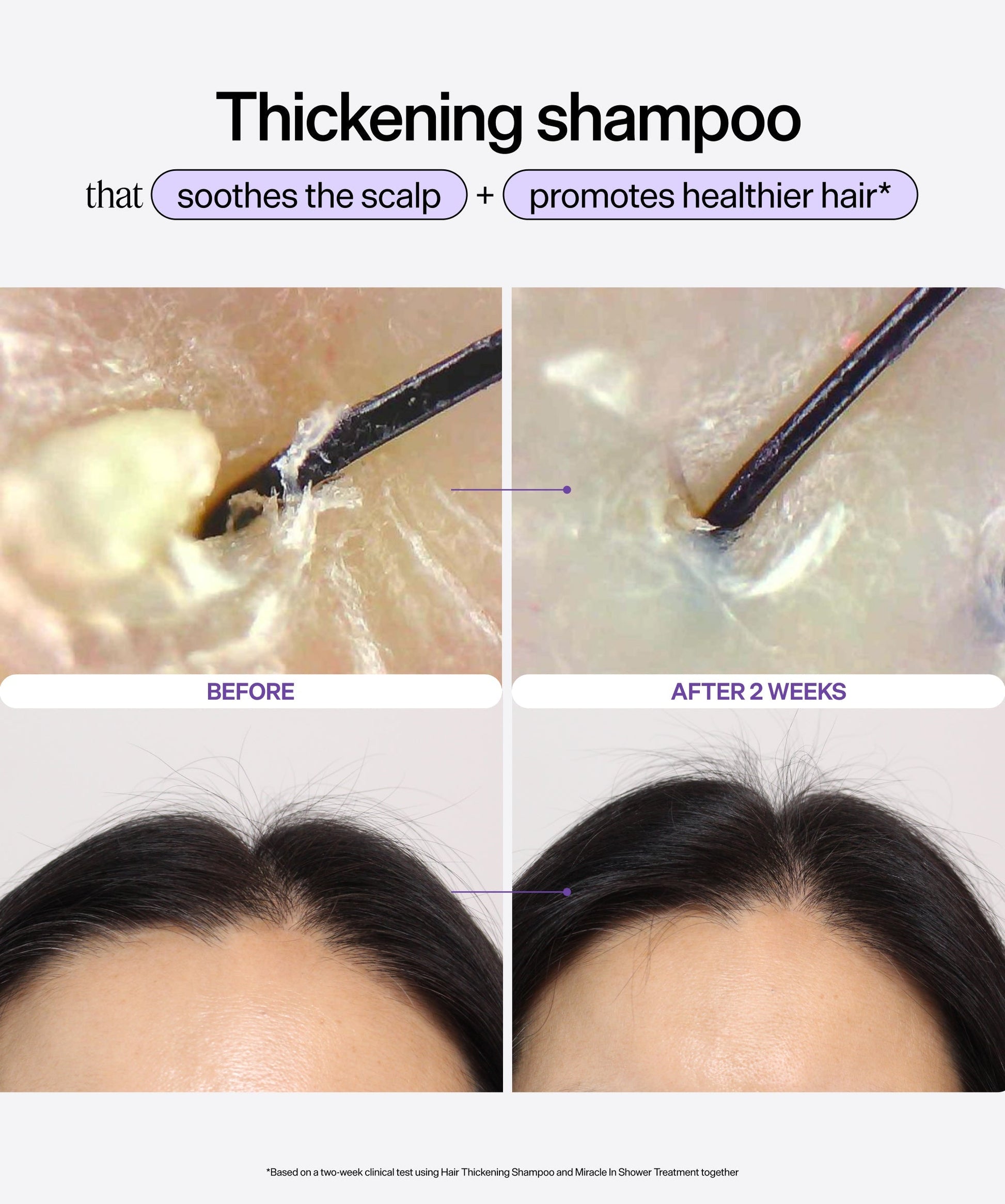 Hair & Scalp Dynamic Duo Set — image 5