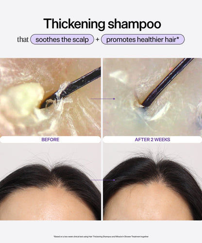 Hair & Scalp Dynamic Duo Set — image 5